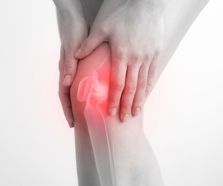 Knee Osteo-arthritis treatment melbourne